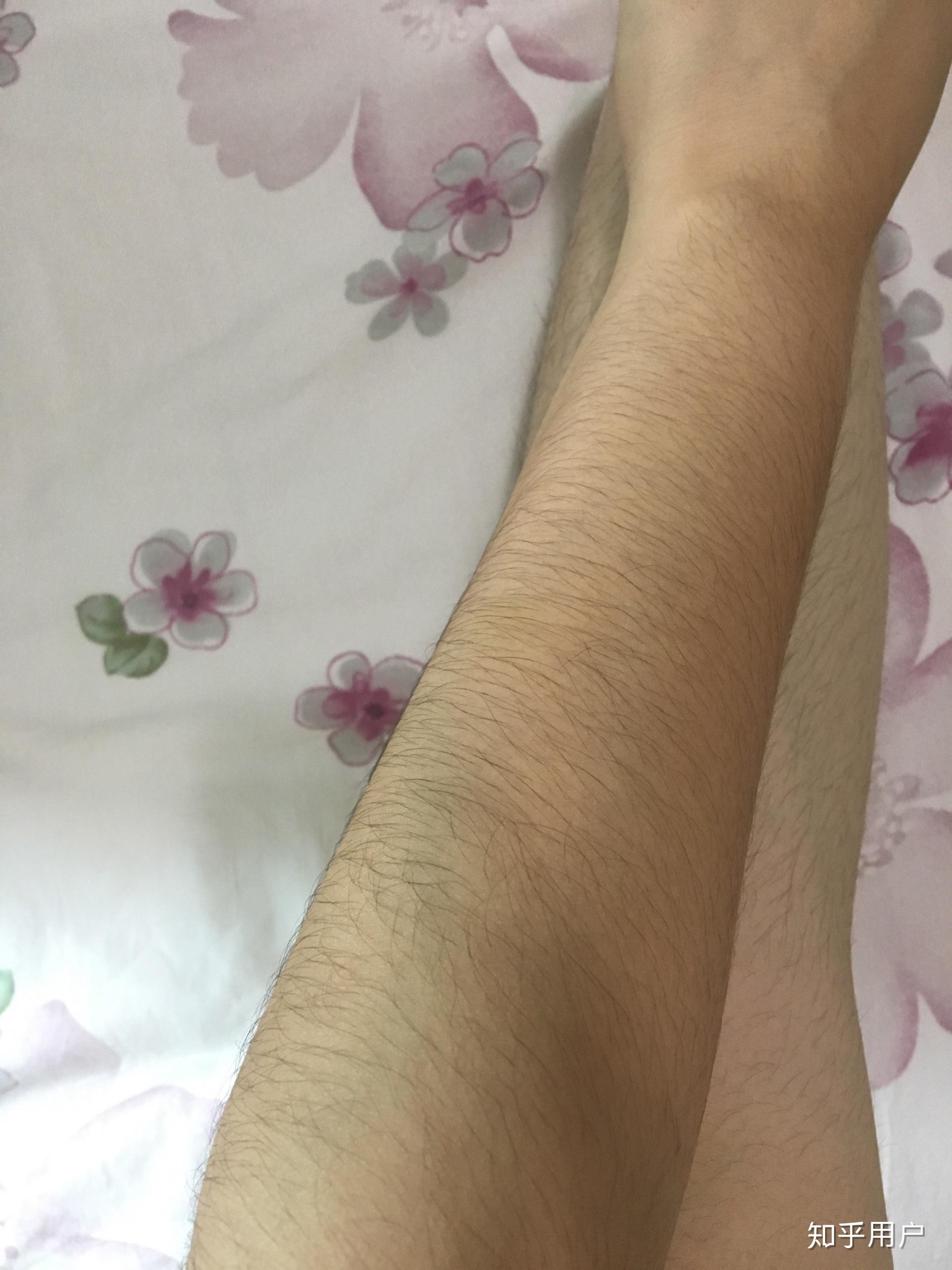 女生体毛旺盛是什么样的体验