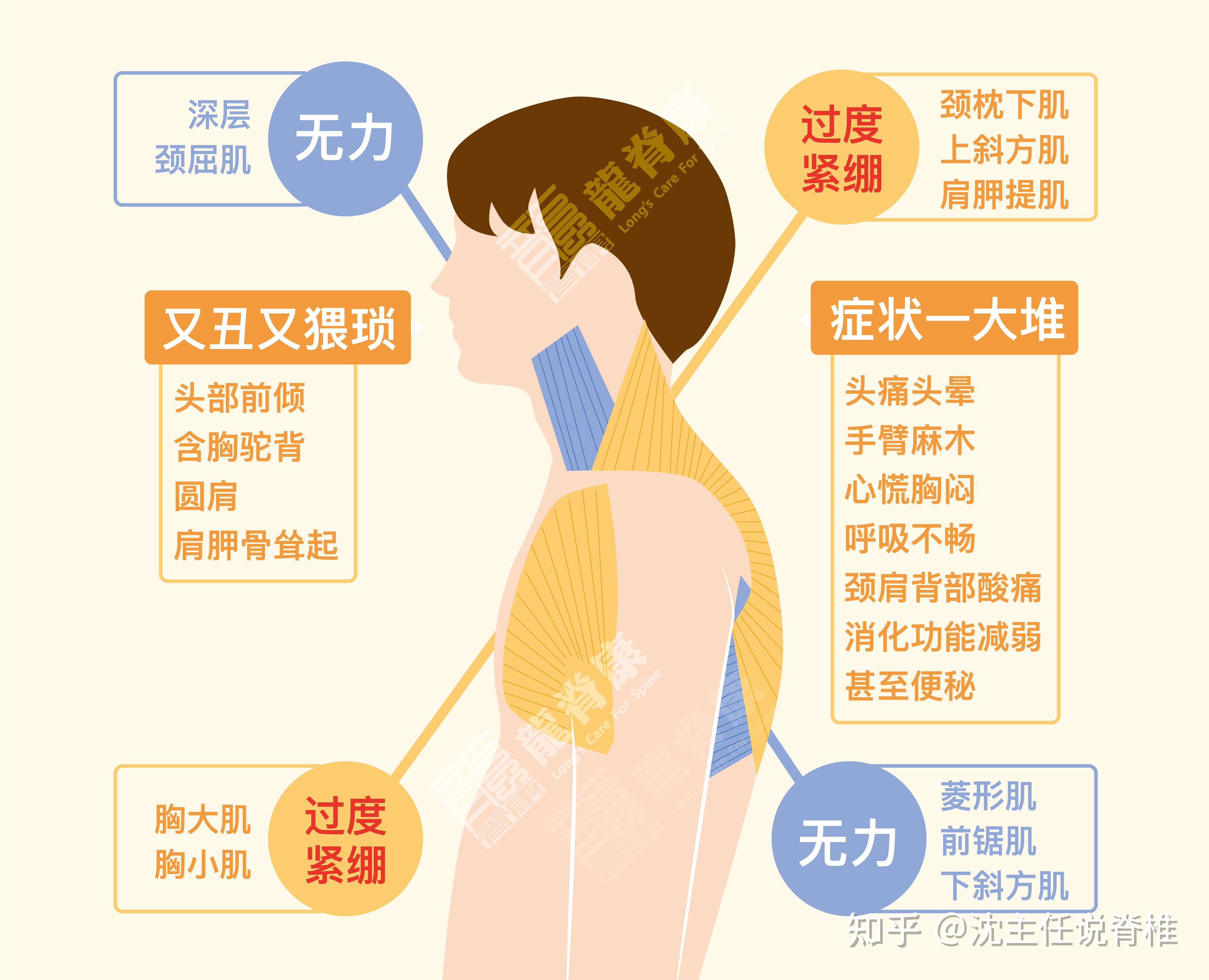 头前伸、含胸驼背怎么办?4个动作帮你快速改善 - 知乎