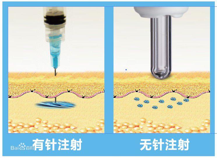 被扎的哇哇叫,关于打针,你需要了解什么? - 知乎
