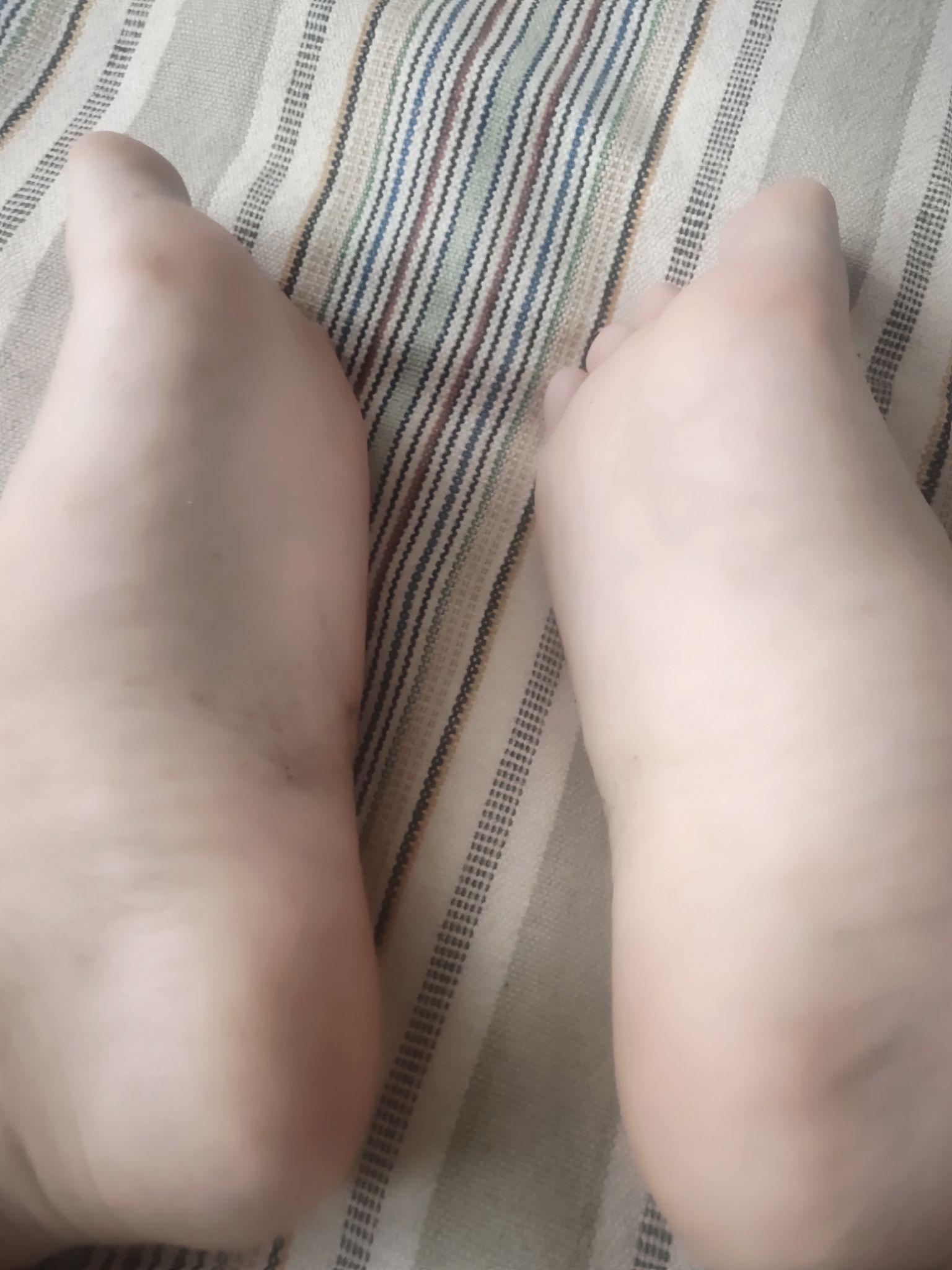 男孩脚底照片有什么问题吗