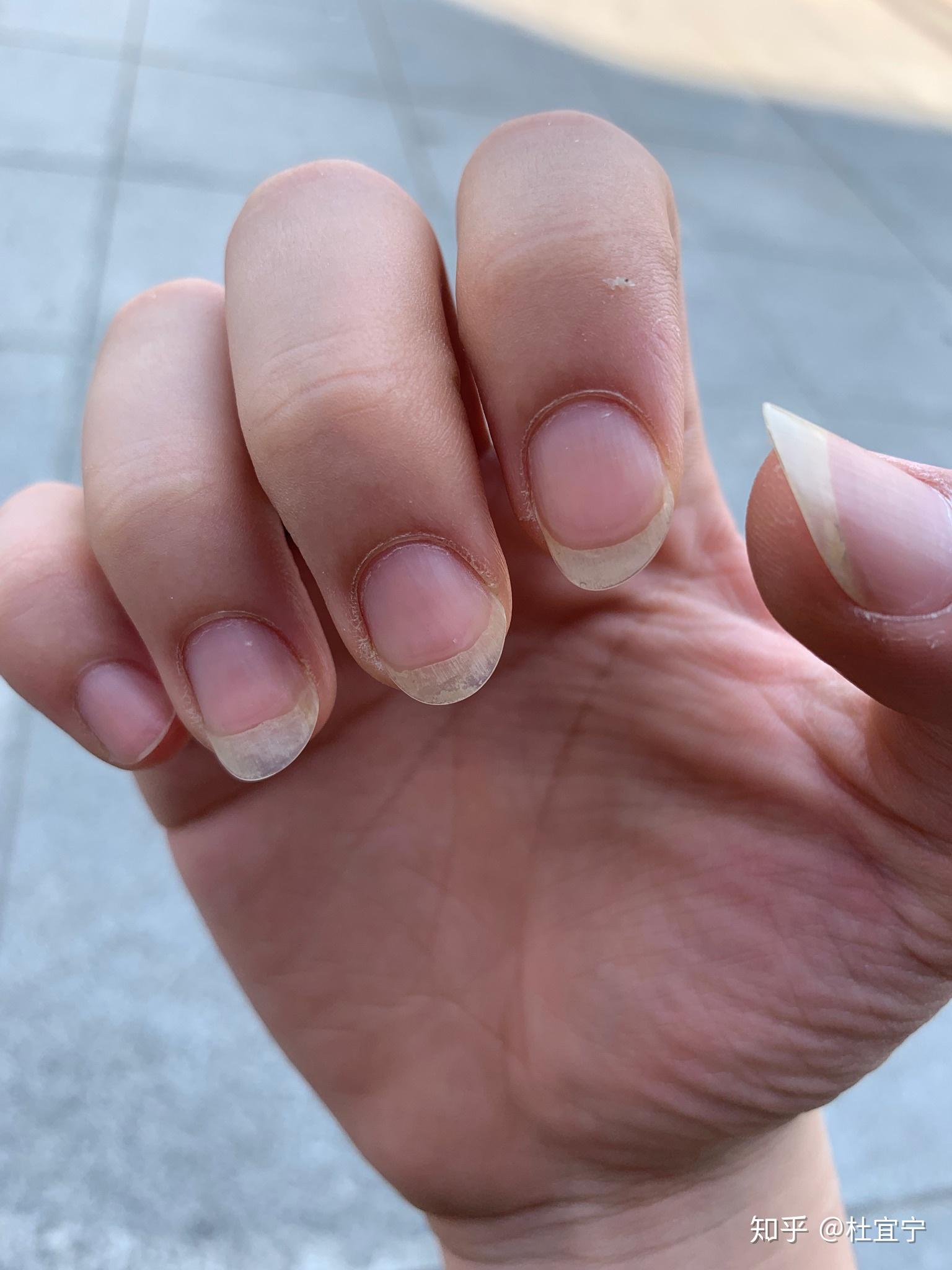 弹古典吉他要怎么留指甲本人女