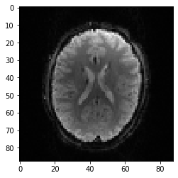 基于Python的MRI图像处理——数据转换与读取 - 知乎