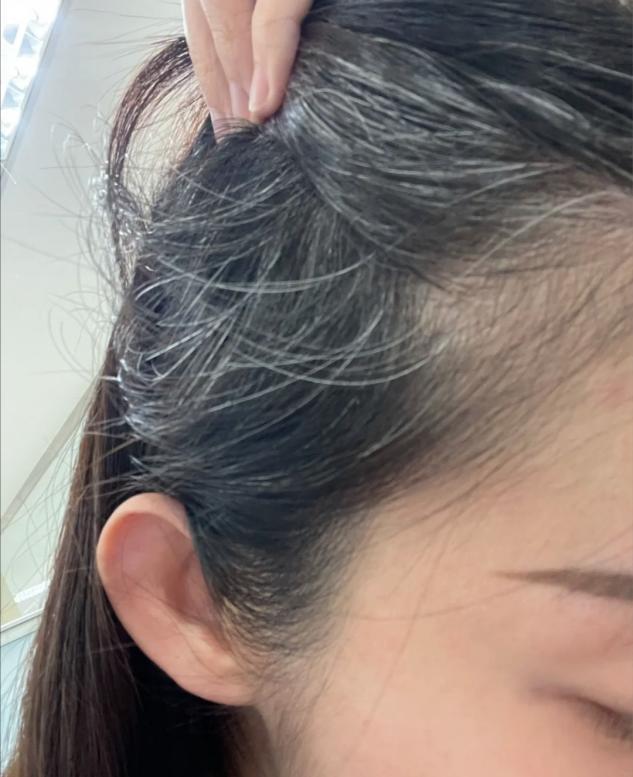 年纪轻轻的女孩子有白头发怎么办? - 知乎