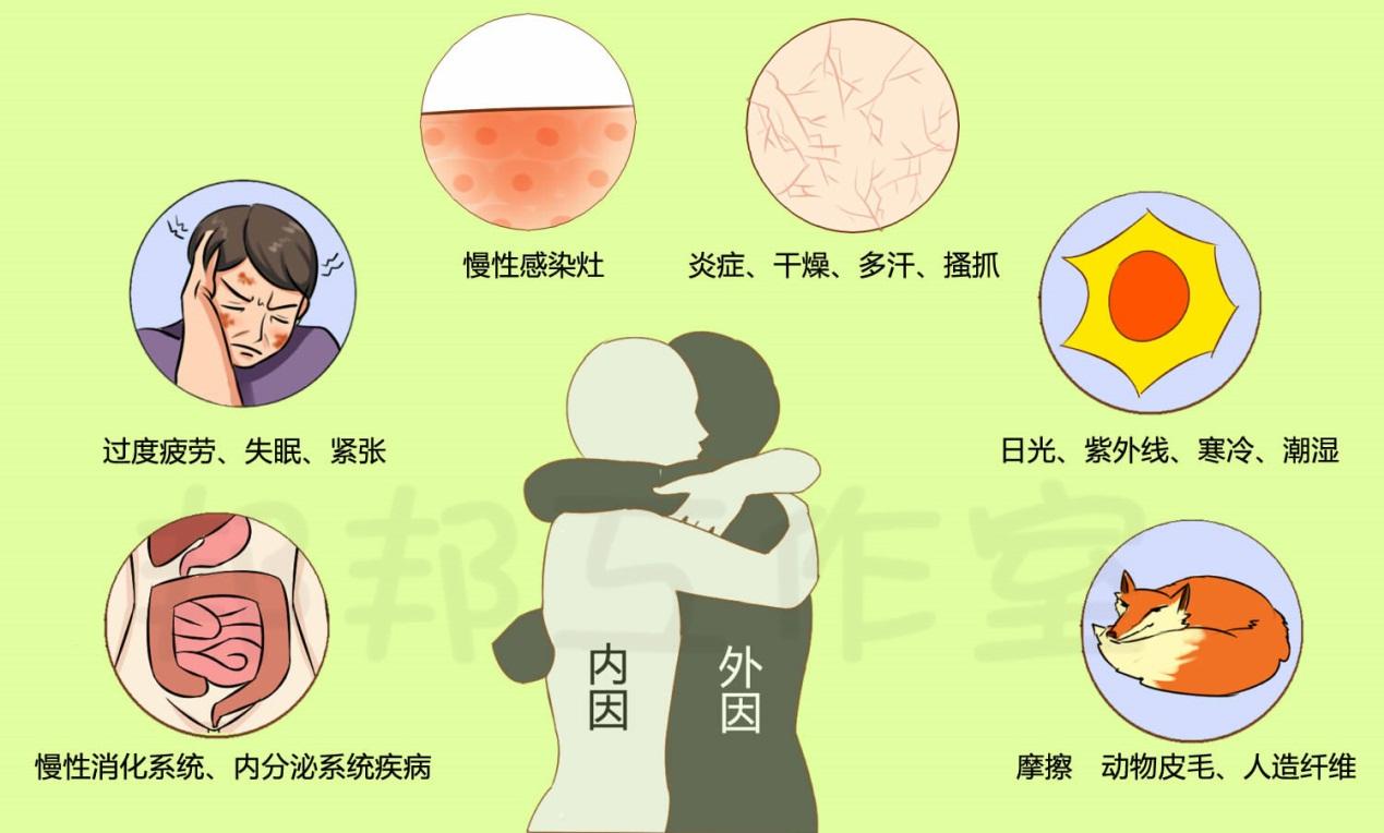 湿疹痒痒痒，该如何分期治疗？ - 知乎