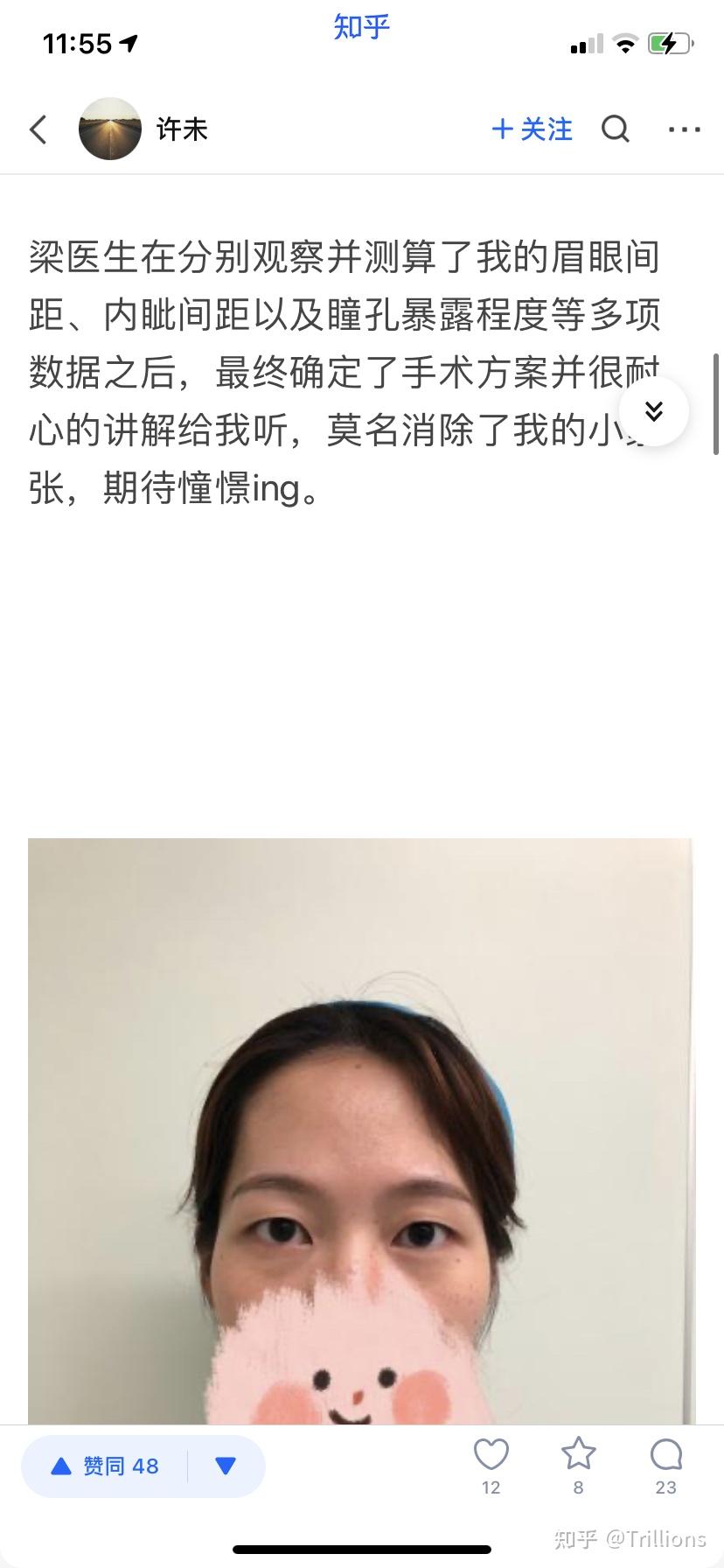 九院梁奕敏医生怎么样?