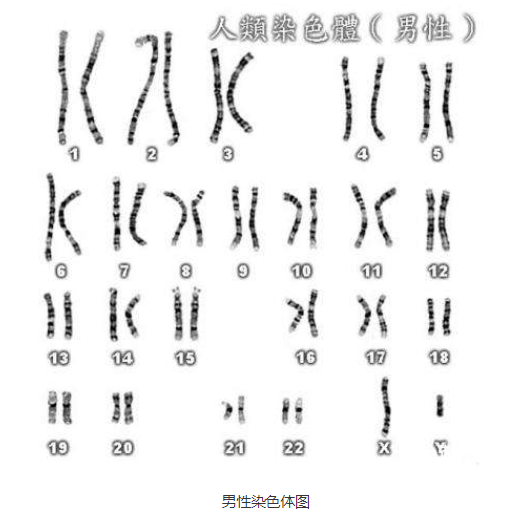 25 岁已婚女子竟被意外查出染色体核型结果为46xy是男性,是什么原因