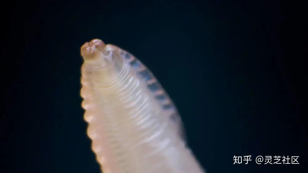 认识肠道寄生虫病 丨 寄生虫病科普系列(一) - 知乎