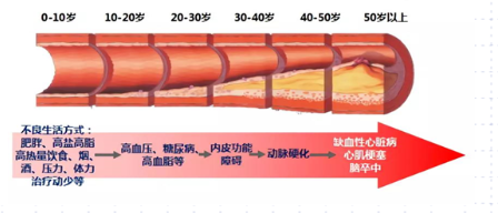 一文说尽血脂:病人和基层医生必读 - 知乎
