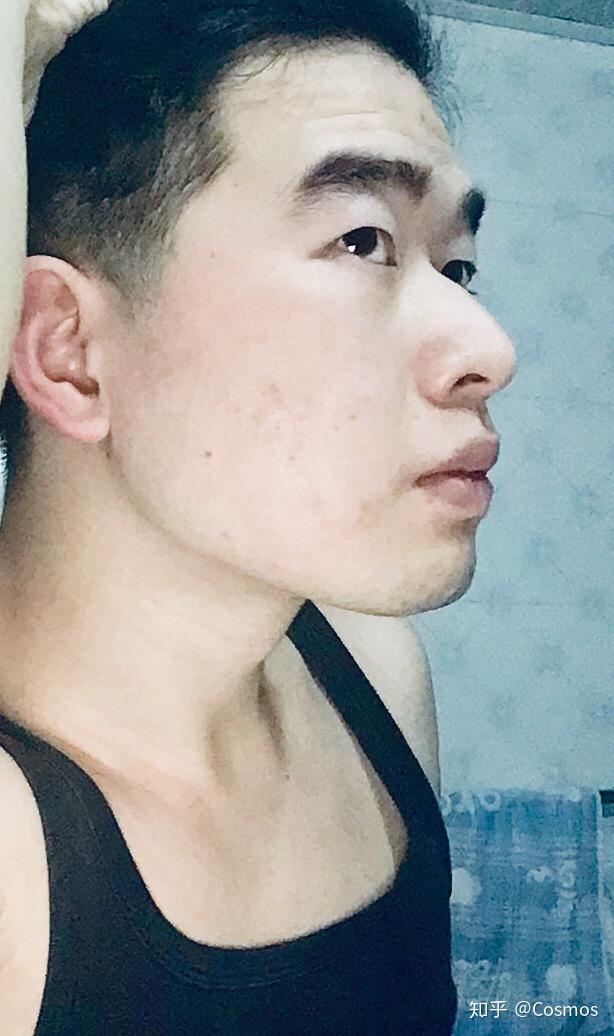 鼻子高但是山根低是什么样