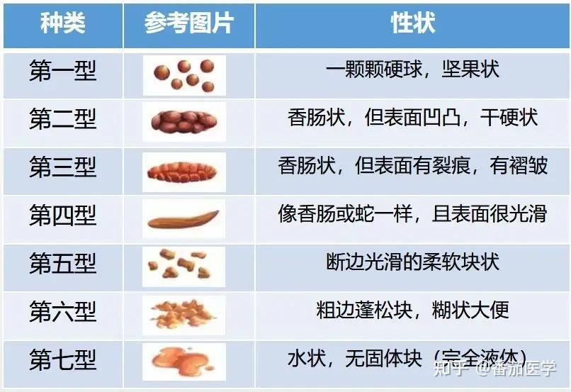 关于拉屎的两三事 - 知乎