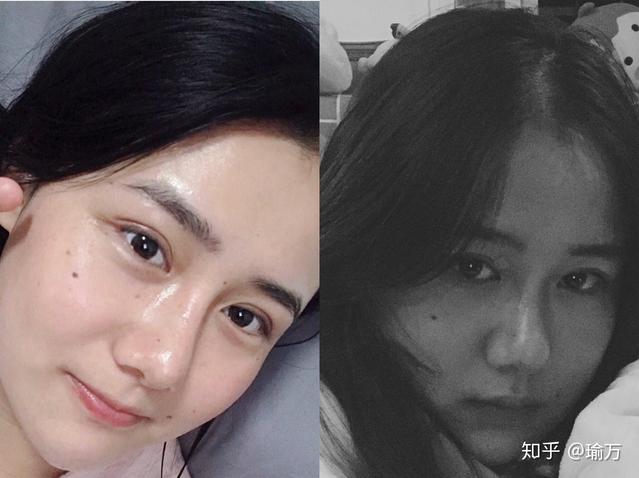 割完双眼皮的姐妹有什么宝贵意见?