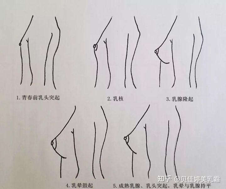 乳房发育不良常见的症状有哪些? 