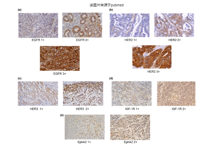 免疫组化常见问题及经验总结(一） - 知乎