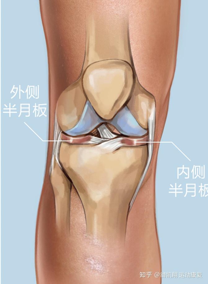 膝盖半月板轻度受伤,应该避免做哪些运动? - 知乎