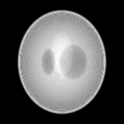 MATLAB医学成像模拟——锥束CT(CBCT)成像模拟 - 知乎