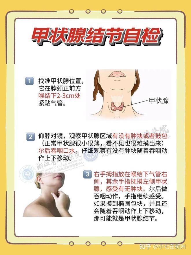 甲状腺癌是不是很好治愈的?