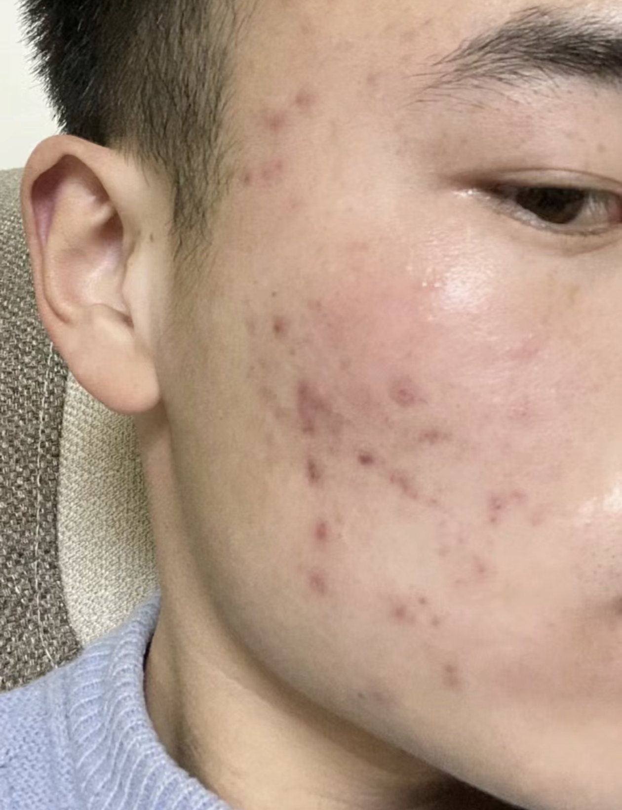 痘印男进!男生好用乳液推荐!