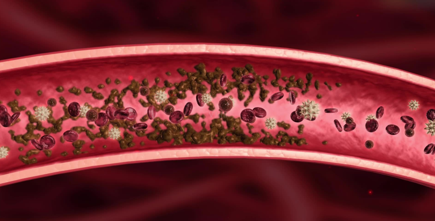 血液垃圾是什么?如何清除血液垃圾毒素?