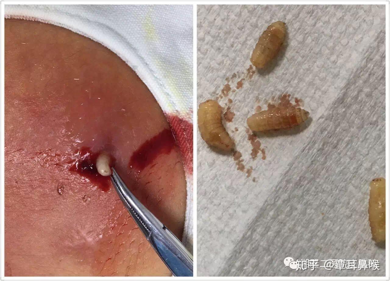 活体会生蛆吗? - 知乎