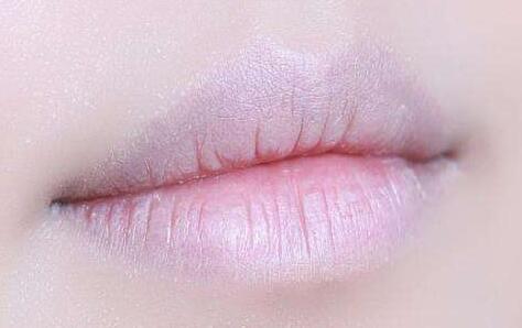 嘴唇发白是怎么回事?