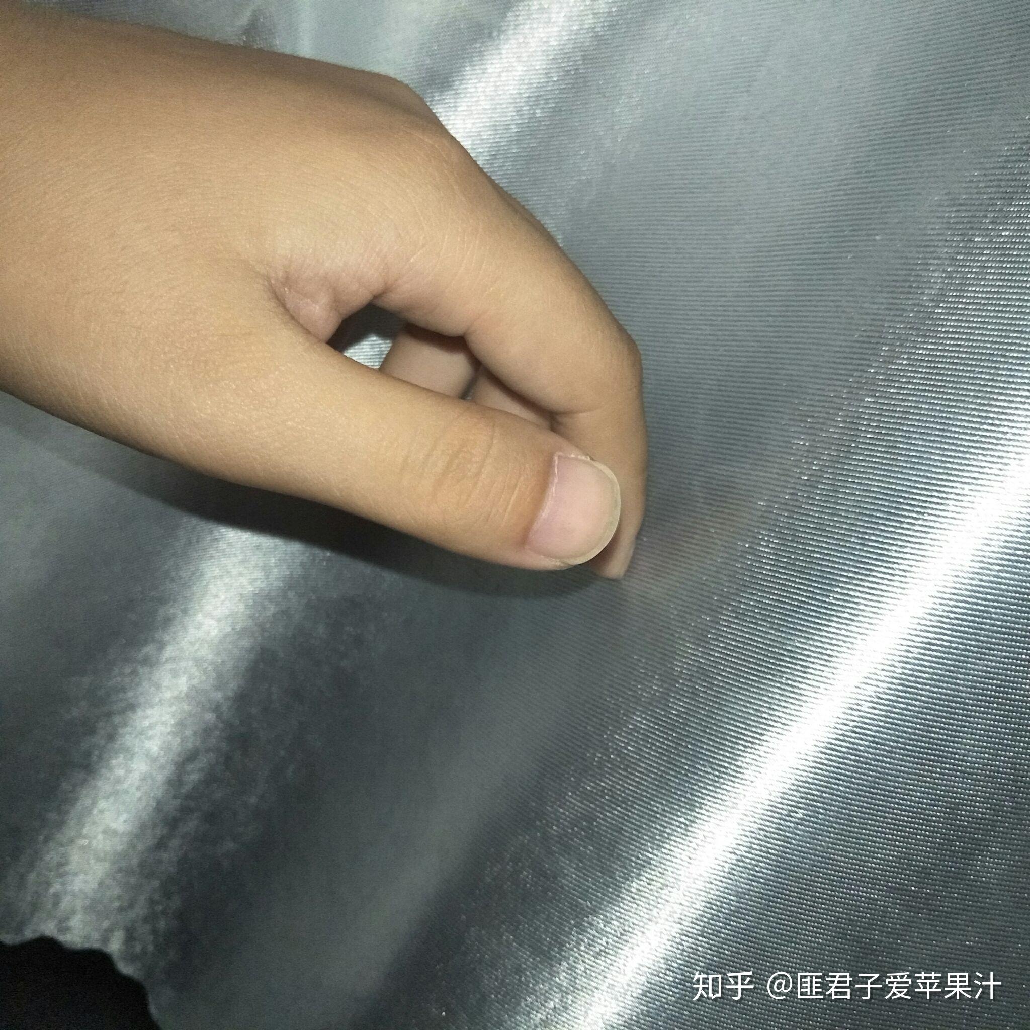 为什么我的大拇指又宽又短?