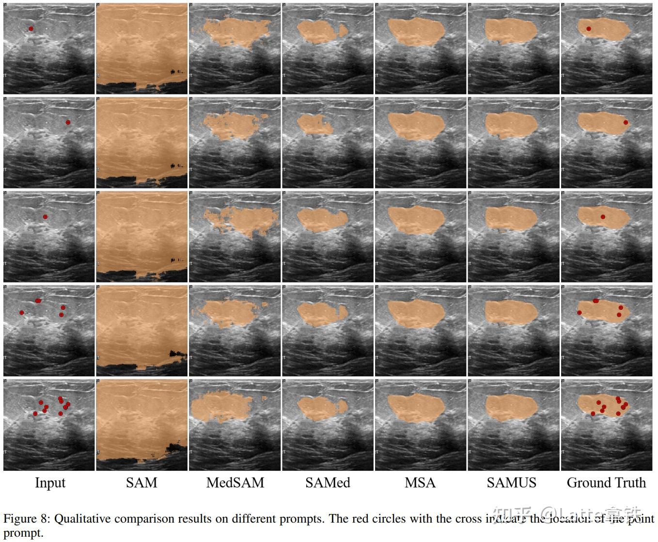  arxiv 2309 samus segment anything model samus 
