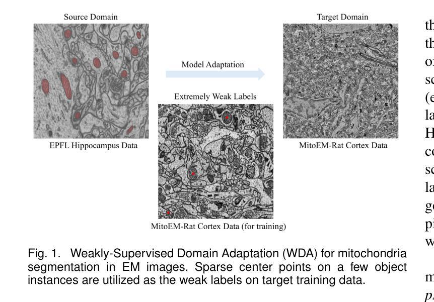无监督/半监督/对比学习