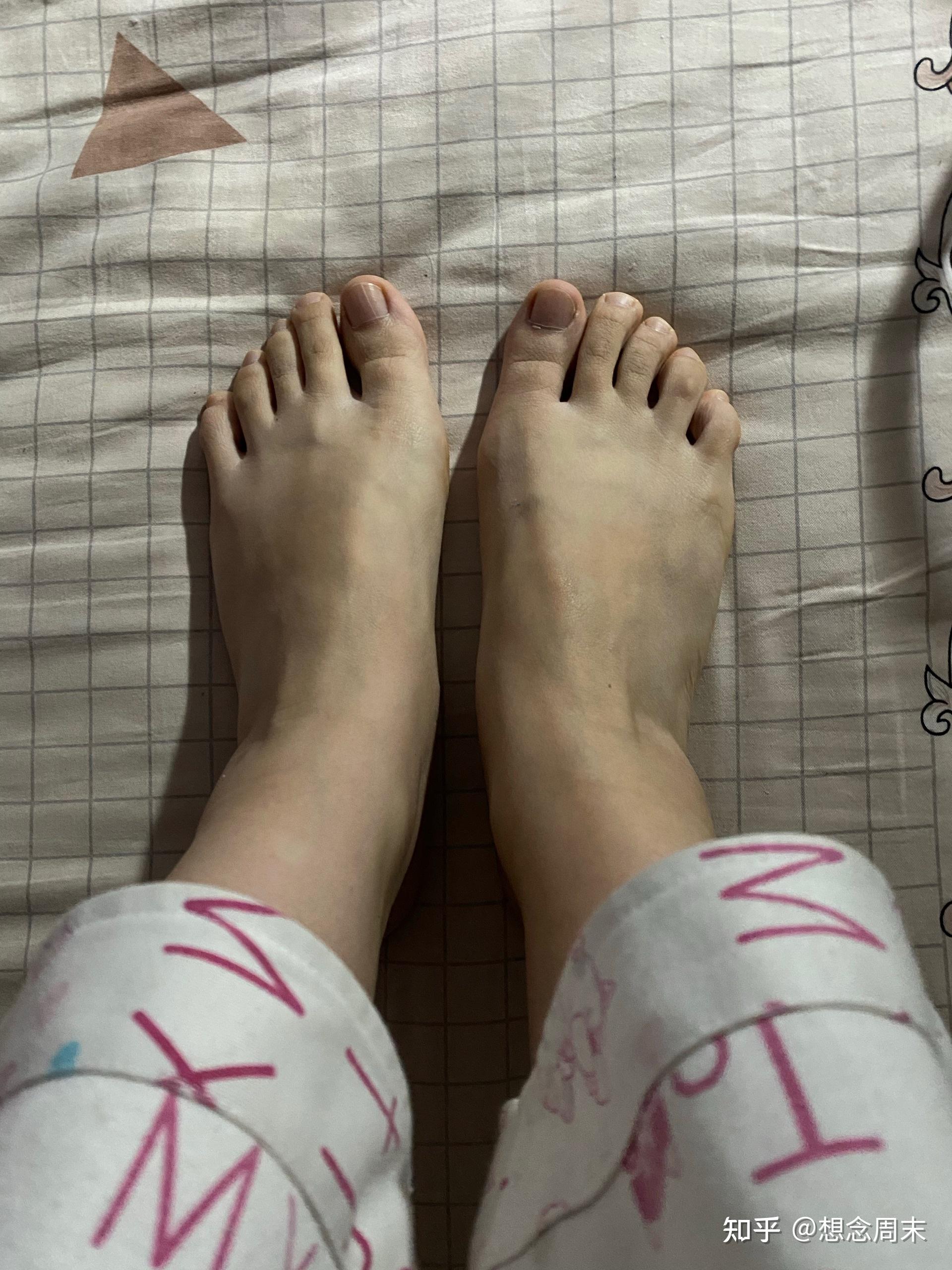 左脚穿鞋很舒服,右脚中间部位总感觉有个东西咯脚似得 很难受,咋解决