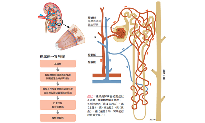 小便有泡泡,是肾脏问题吗? - 知乎