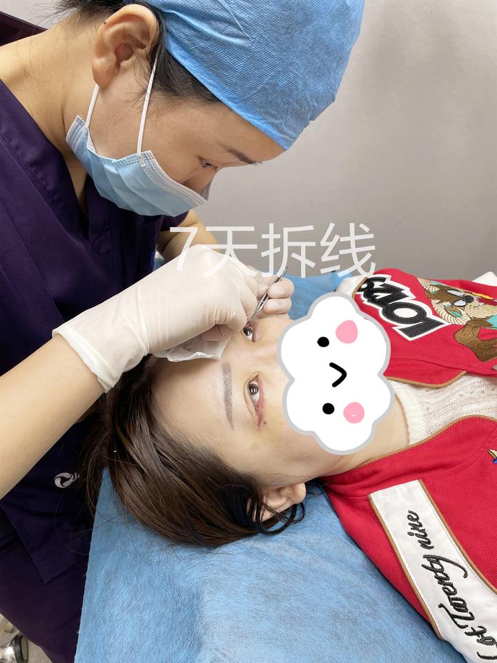 为了过年不闹心,别再做下睑下至和开外眼角了 - 知乎