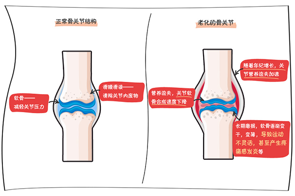 跨越年龄界限的守护：全面揭秘骨关节健康养护之道 知乎 