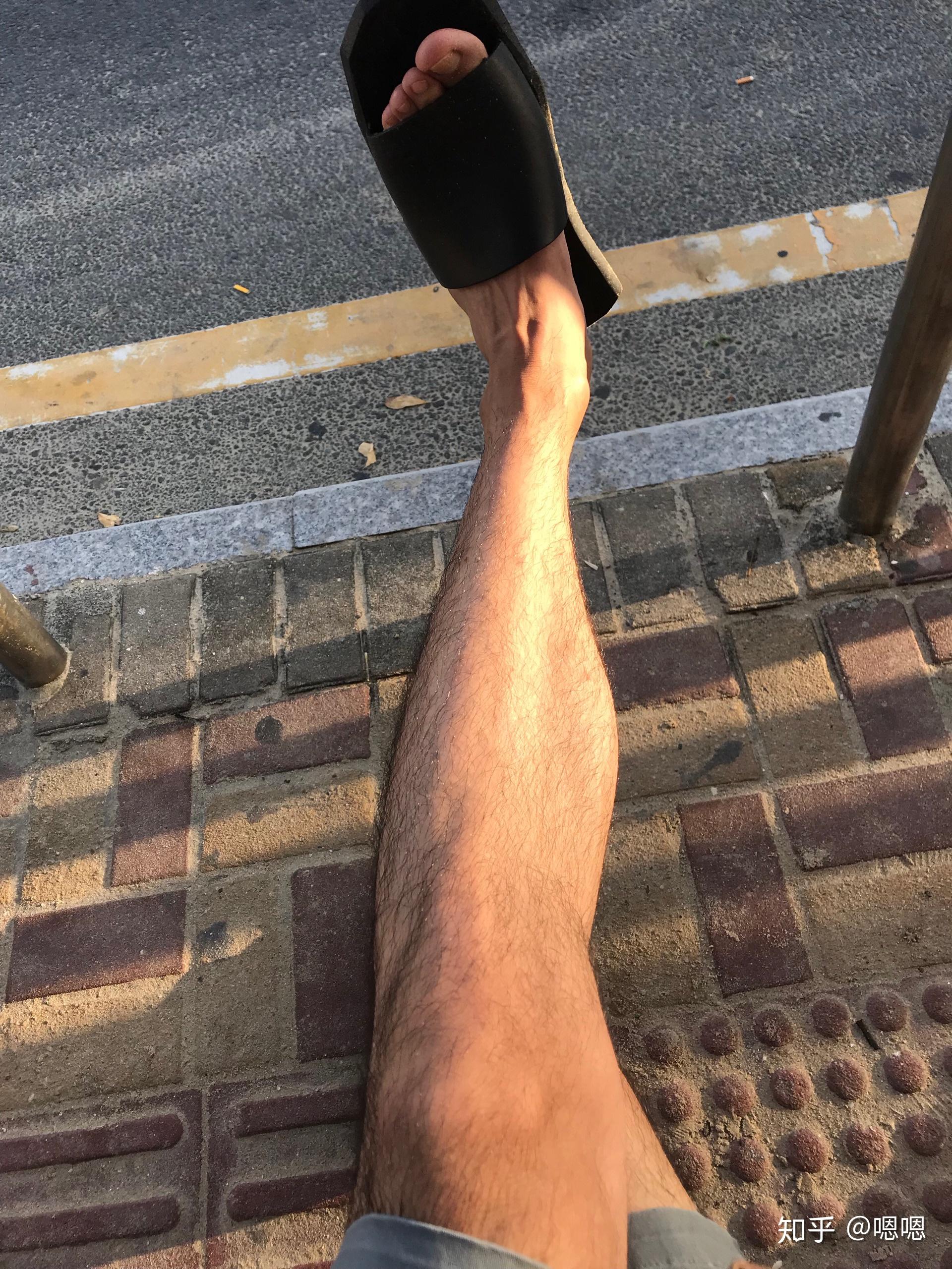 男生腿毛浓密怎么办? - 知乎
