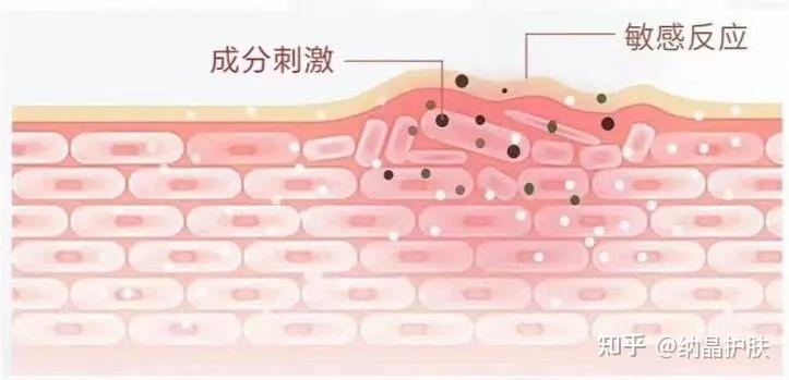 明明是补水,皮肤为什么会有刺痛感? - 知乎