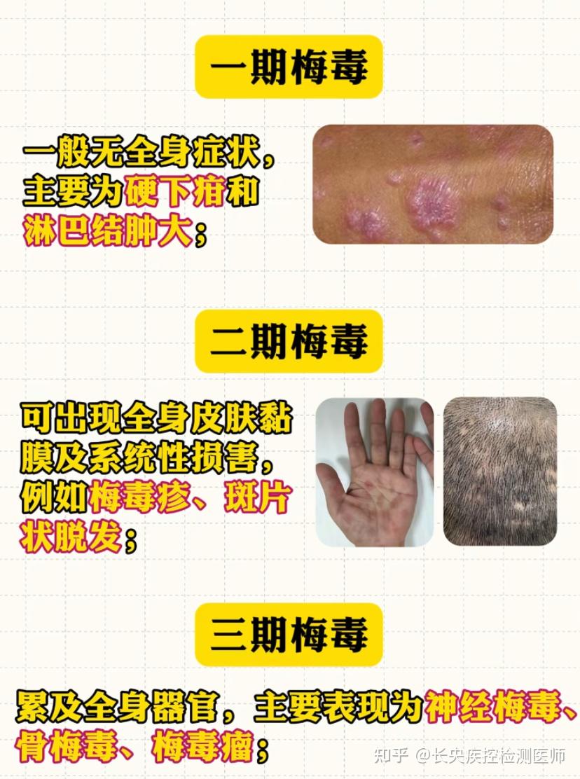 大夫这个是梅毒疹吗半年了肚子上?