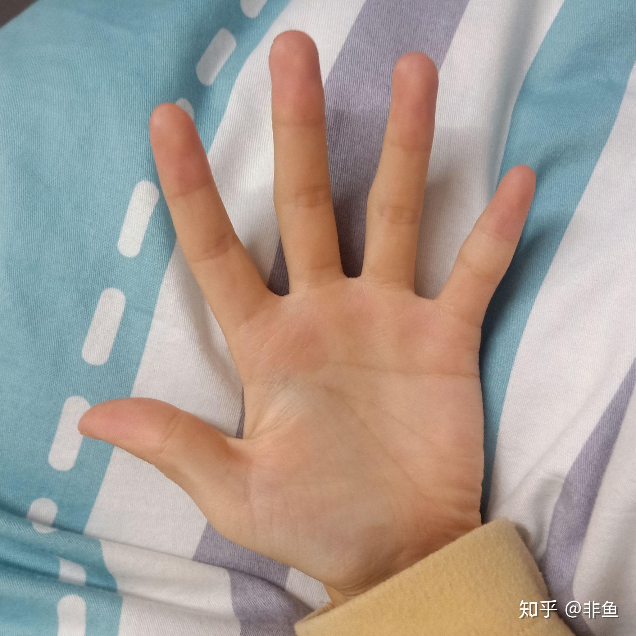 男生的手又细又长又嫩,像极了女生的手,因此感到自卑,怎么办?