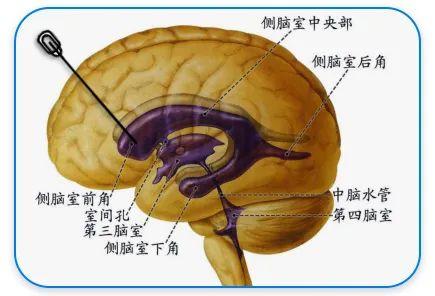 助力神经系统药物研发:大动物PK中的探索与应用 - 知乎