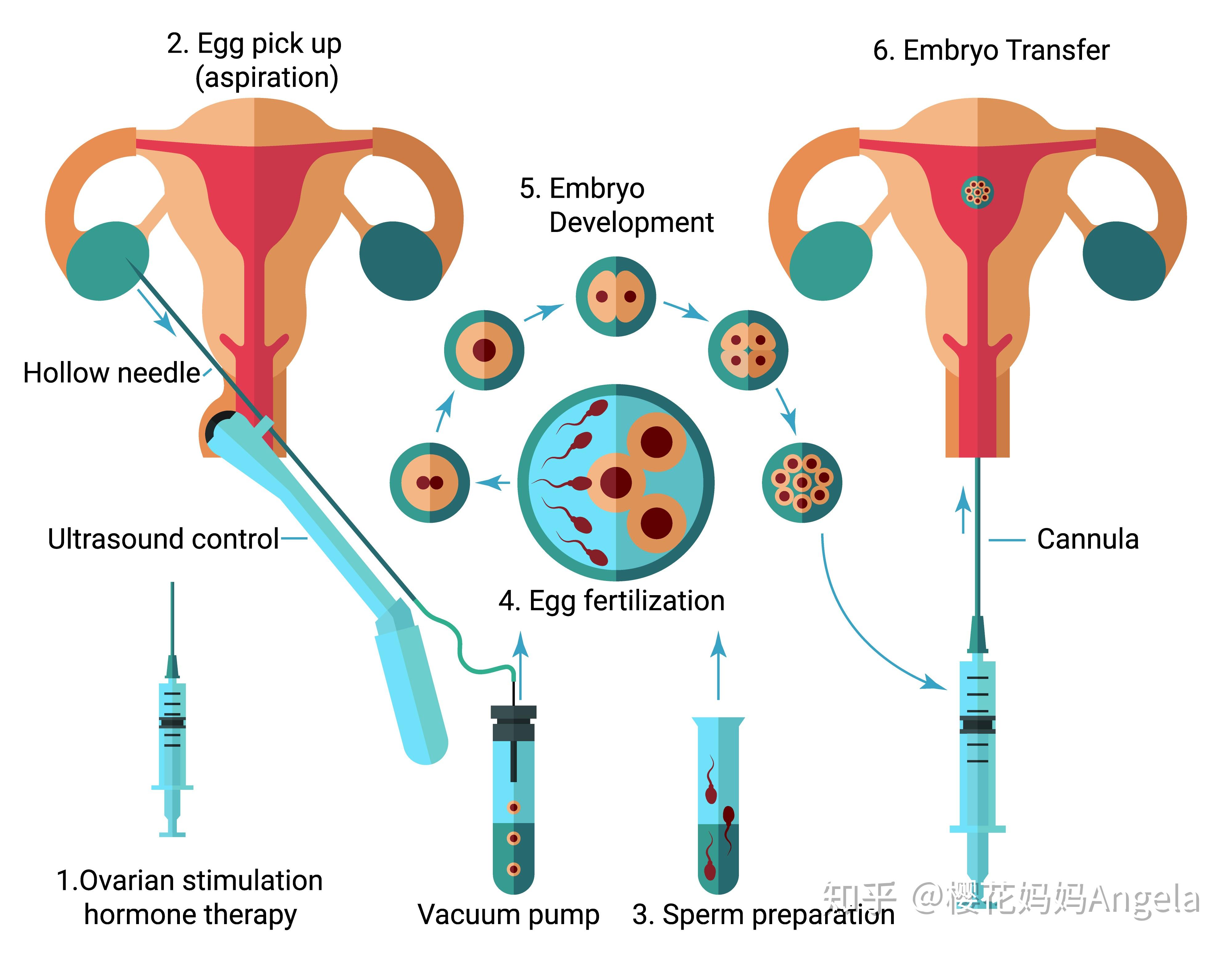 试管婴儿与自然受孕婴儿健康发育有没有差别有什么差别你呢