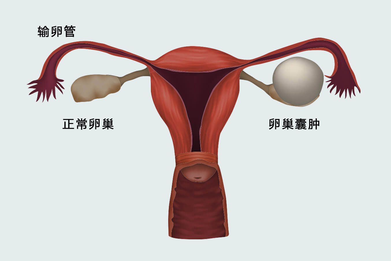 我做个小手术,为什么妈妈坚决不让别人知道这件事?