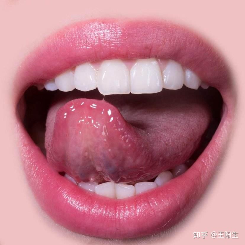 中医看病,为什么都要让你伸出来舌头呢? - 知乎