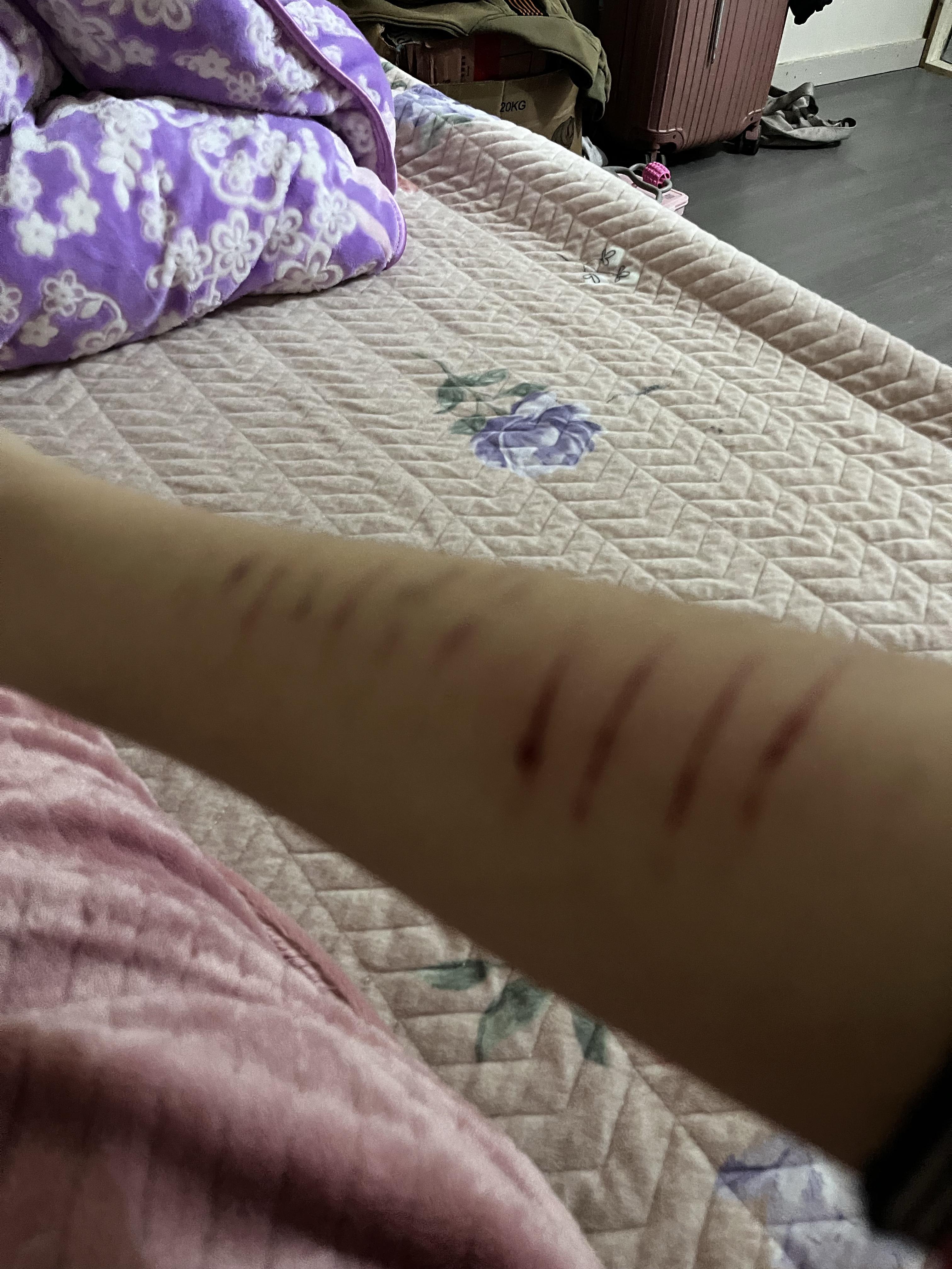 想看看真正的抑郁是什么样的?