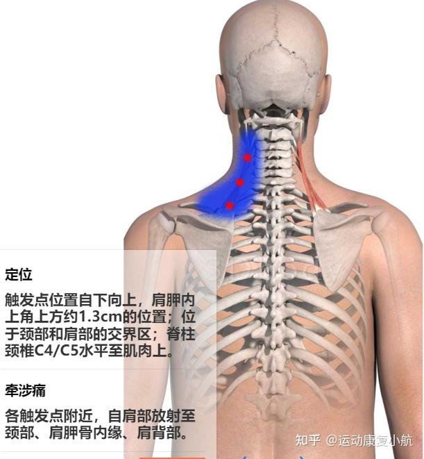 肩背酸痛是哪些疾病的临床表现