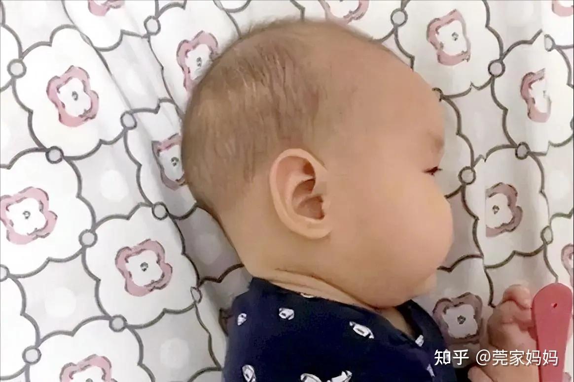 扁头的危害已经非常普及了，那尖头（舟状头）有什么危害呢？ - 知乎