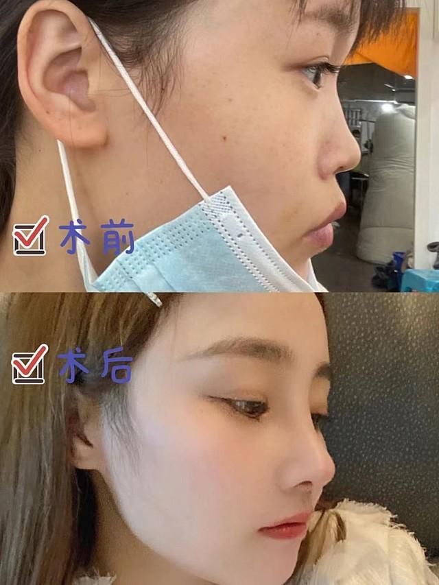 小姐姐肋骨鼻综合体验过程真的很不错