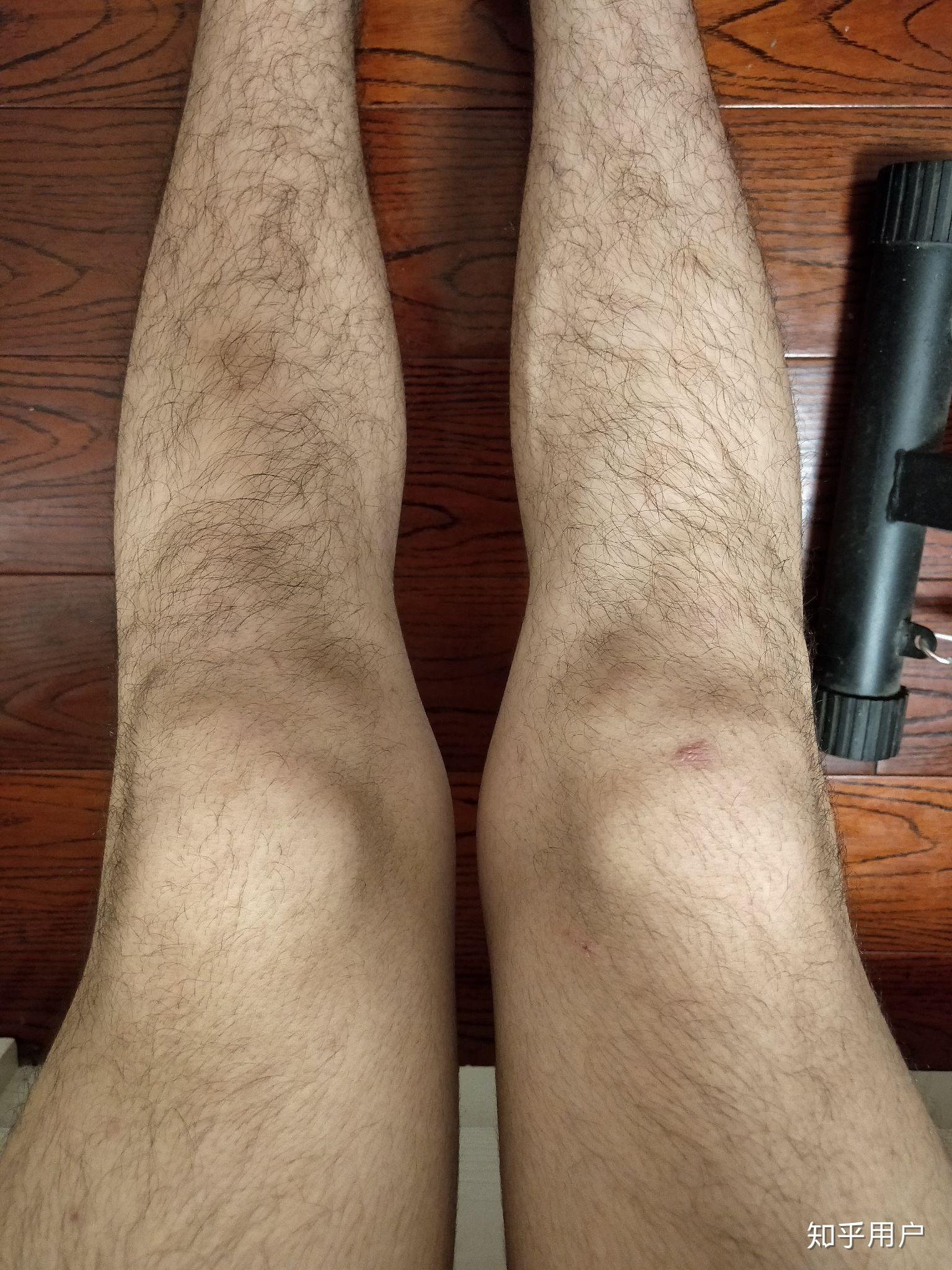 腿毛旺盛的男人图片