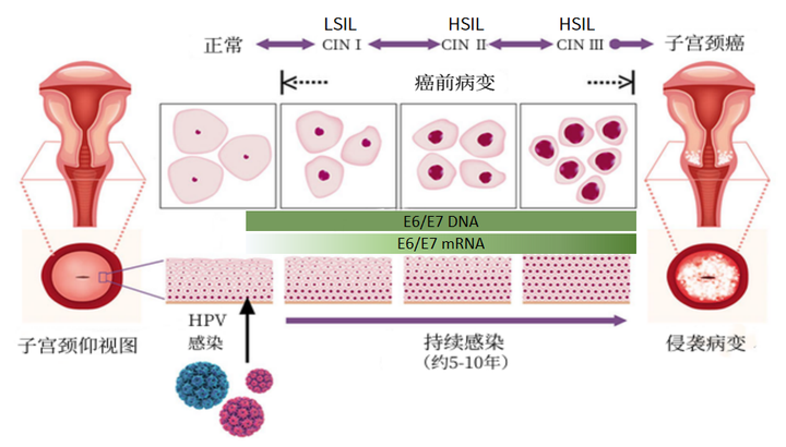 为什么要检测HPV E6/E7 mRNA呢？ - 知乎