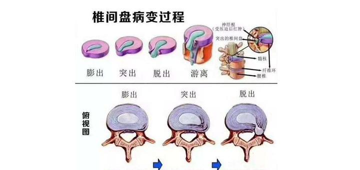 正常腰椎形状图片大全图片