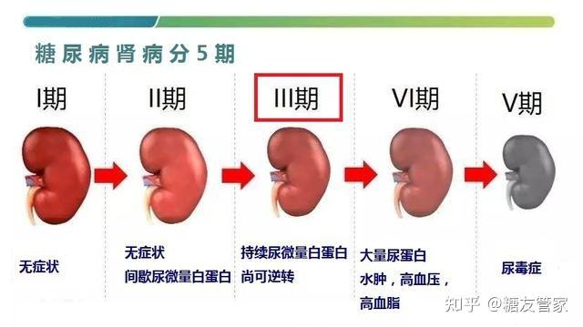 糖尿病肾病会导致身体有哪些症状