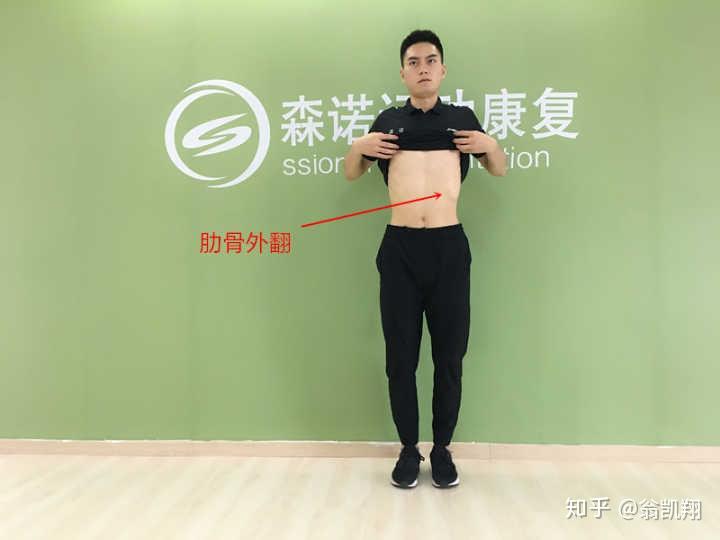 肋骨两边不一样高要不要去医院看看?