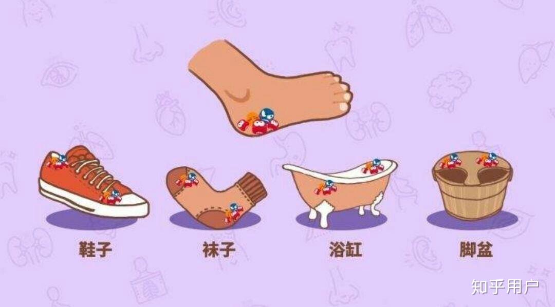 我想知道长脚气是什么原因引起的?