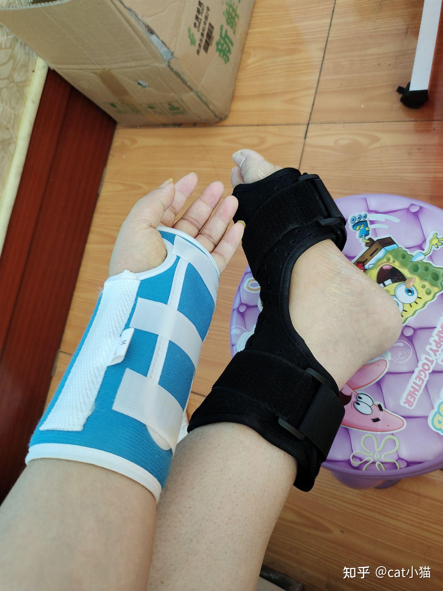 左脚第二三跖骨基底骨折,怎么康复治疗?求指导? - 知乎